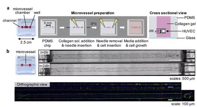 利用芯片制备体外人微血管。图片来源：EBioMedicine