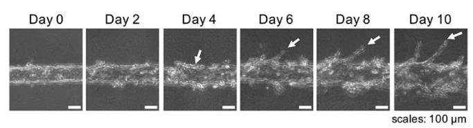 随着时间的推移，可以用显微镜观察到血管的新生。图片来源：EBioMedicine
