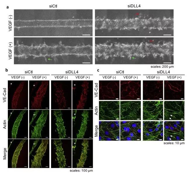 敲除DLL4将影响血管的新生和稳定性。图片来源：EBioMedicine