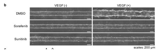 向芯片中添加抗肿瘤药物sorafenib或sunitinib，观察到了血管新生的抑制现象。 图片来源：EBioMedicine