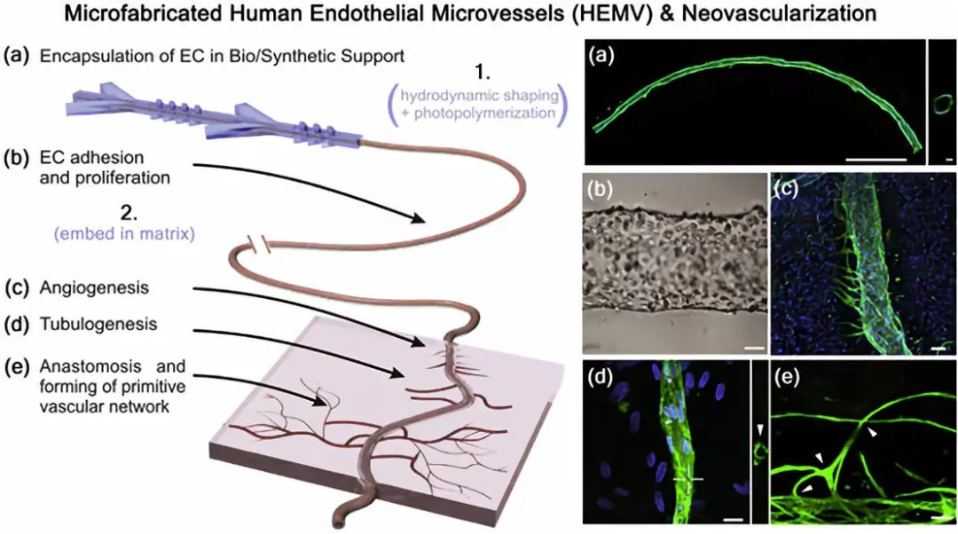 可经历新血管生成以及与正常人血管成熟相关的其他发育过程
