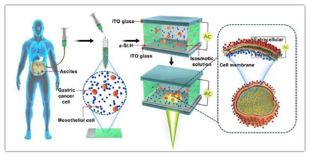 OEK微流控芯片用于检测腹膜转移和细胞膜电容 OEK微流控芯片用于检测腹膜转移和细胞膜电容